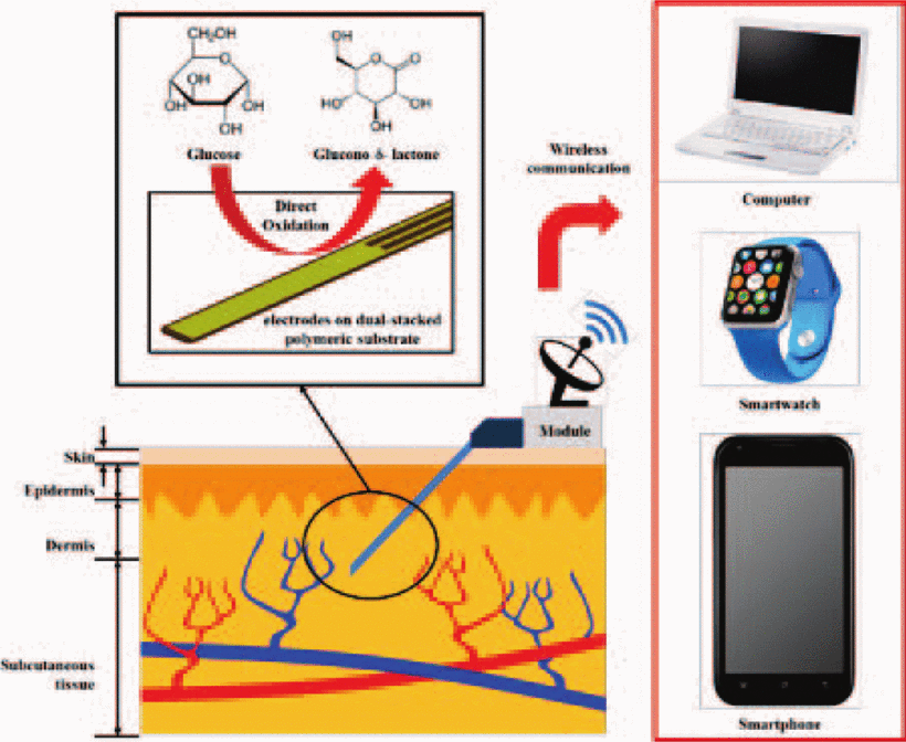 SEMI-IMPLANTABLE GLUCOSE SENSOR BASED ON DUAL-STACKED POLYMERIC FILM FOR WIRELESS CONTINUOUS MONITORING